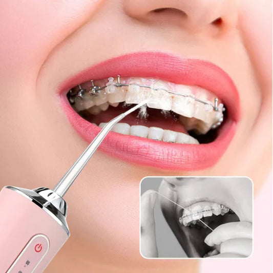 Limpieza profesional en casa💧🦷✨Irrigador Dental Portátil